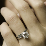 Women undergoing plastic surgery in search of the perfect engagmenet selfie