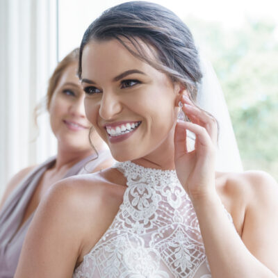 wedding day botox