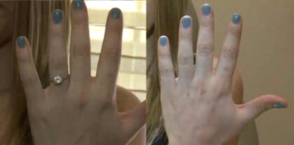 Women undergoing plastic surgery in search of the perfect engagmenet selfie||Women undergoing plastic surgery in search of the perfect engagmenet selfie|||||