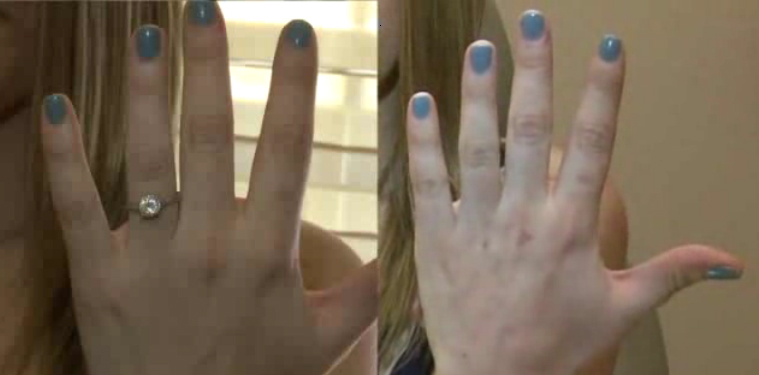 Plastic surgery: Taking engagment selfies too far…