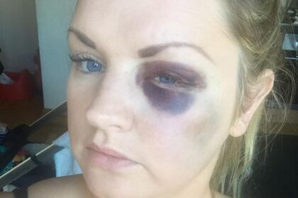 John Paul Campbell. Image: Manchester Evening News.|One of the pictures presented at court show a very bruised Samantha Dewar. Image: Manchester Evening News.|