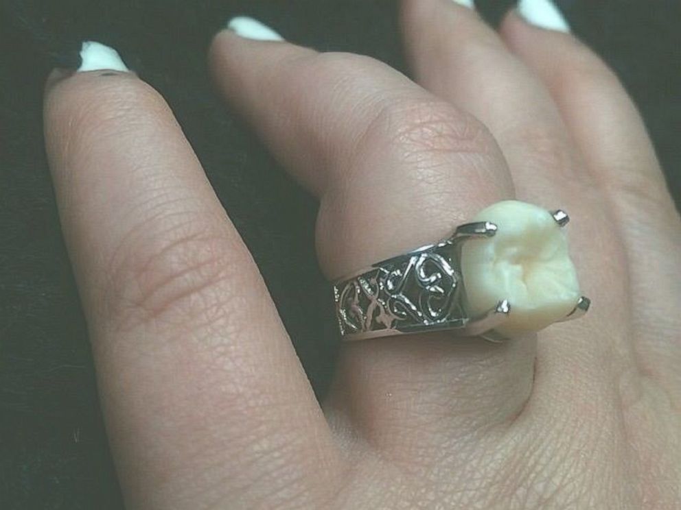 An engagement ring made from a wisdom tooth?
